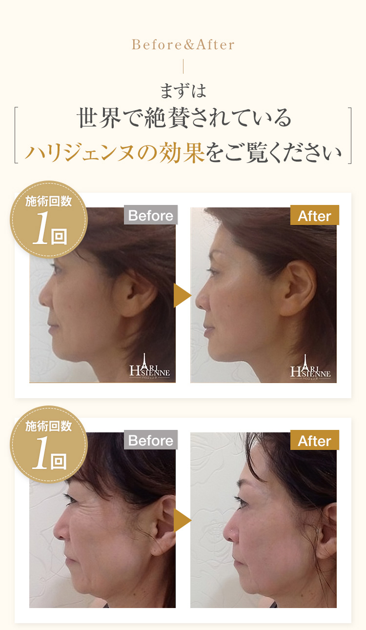 症状写真